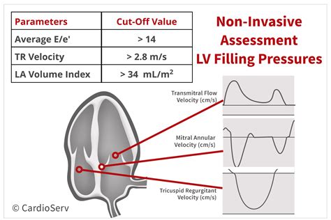 calculate left atrial volume index